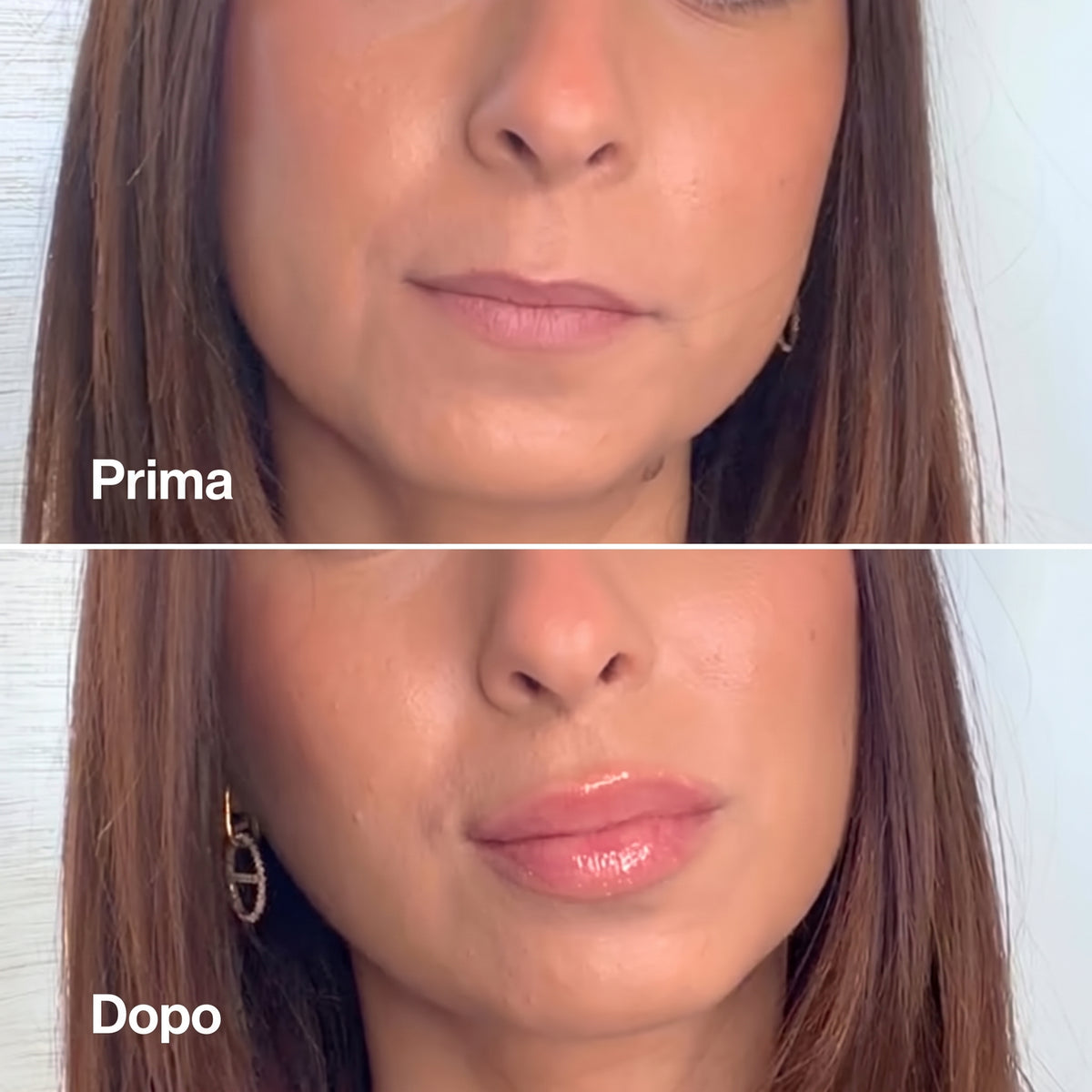 Lip Volume Estremo