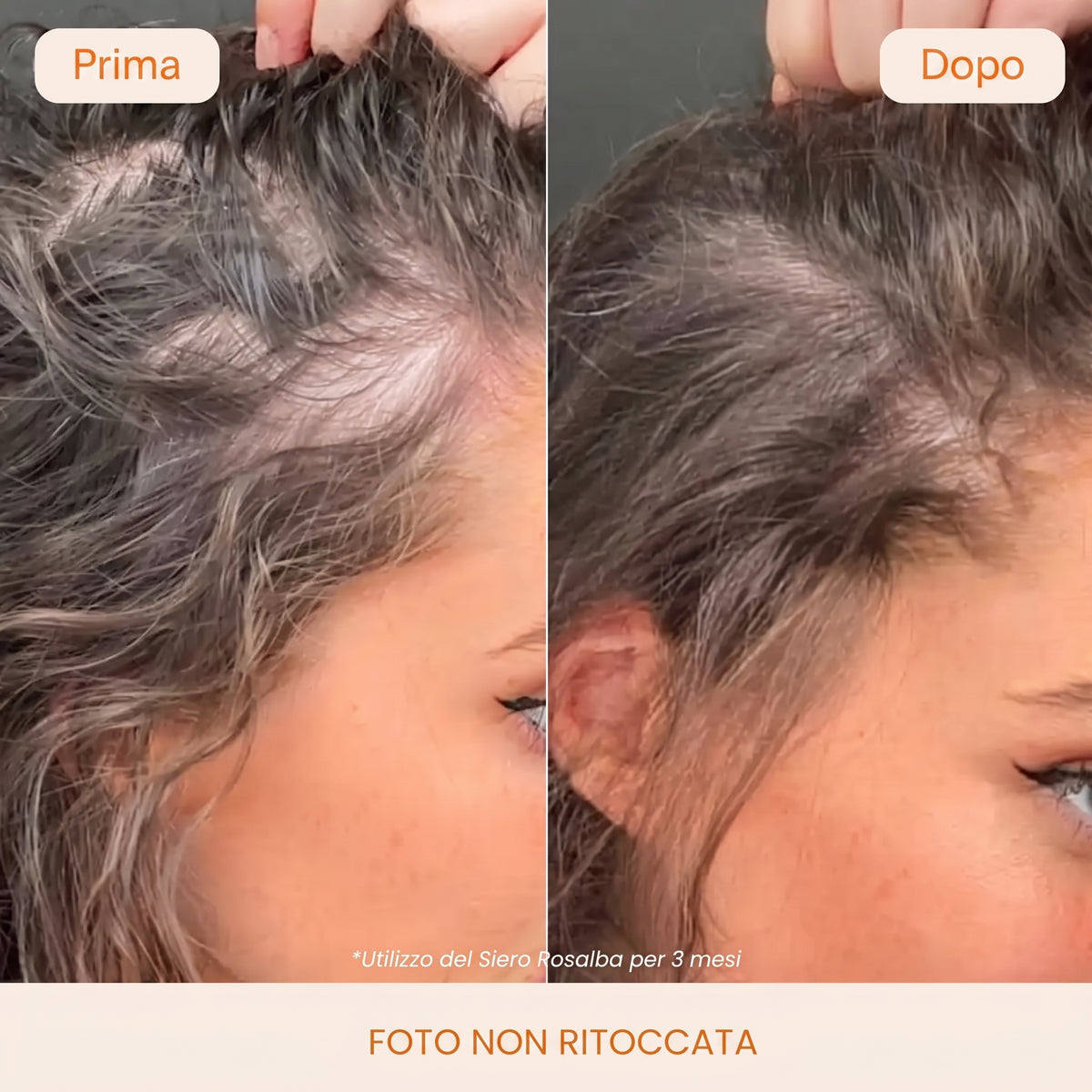 Siero Capillare Rosalba